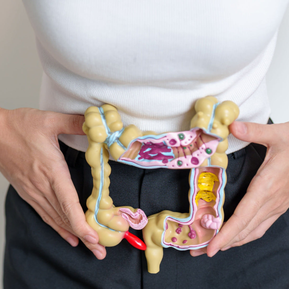 Does Coffee Inflame Ulcerative Colitis?